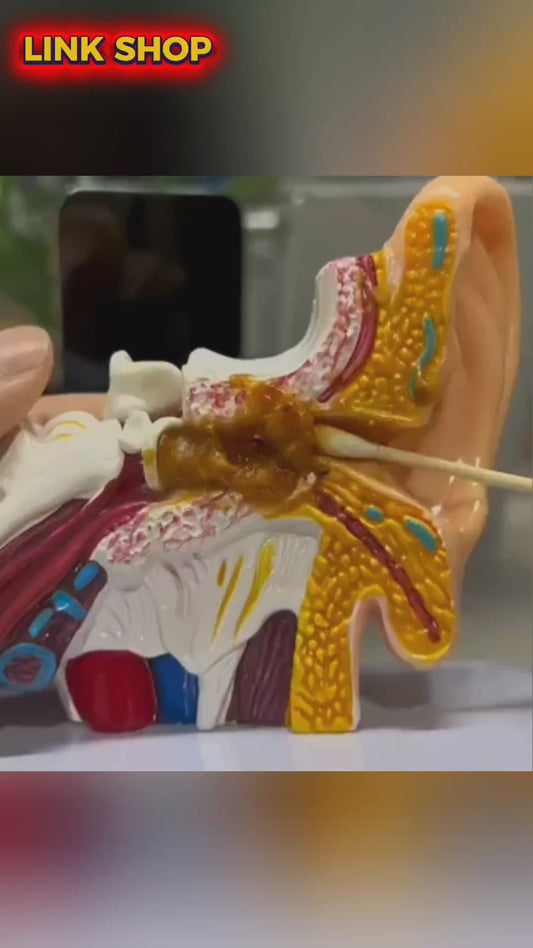 Cure Oreille Visuel Sans Fil avec Caméra HD